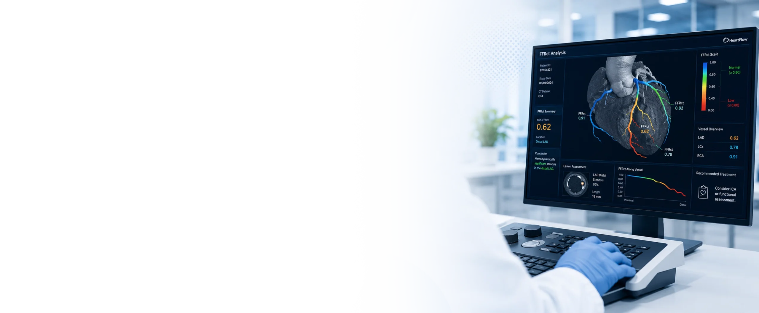 Advanced Diagnostis - FFRCT Report