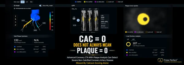 Coronary Calcium Score Vs Coronary CTA