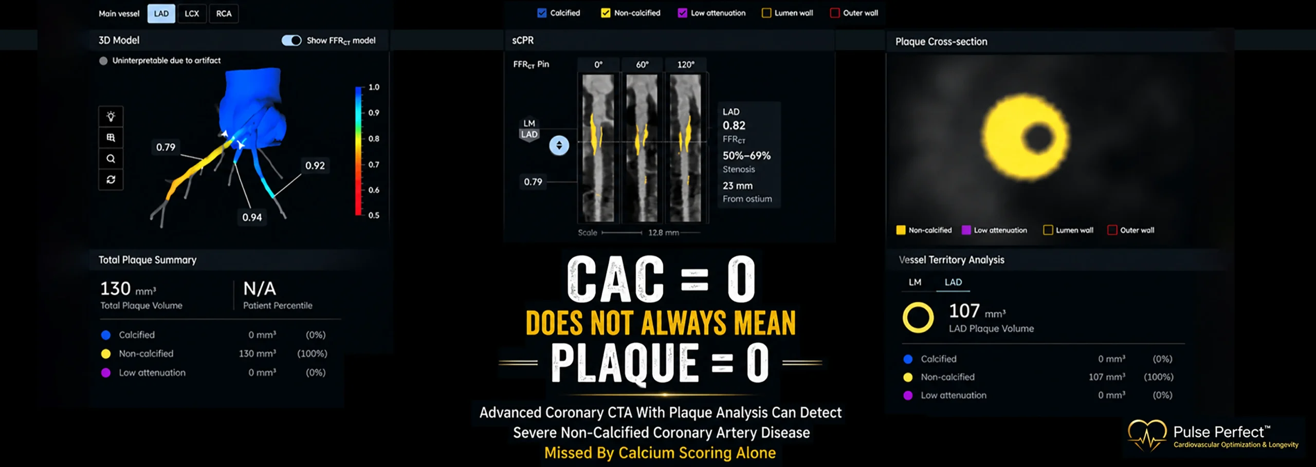 Coronary Calcium Score Vs Coronary CTA